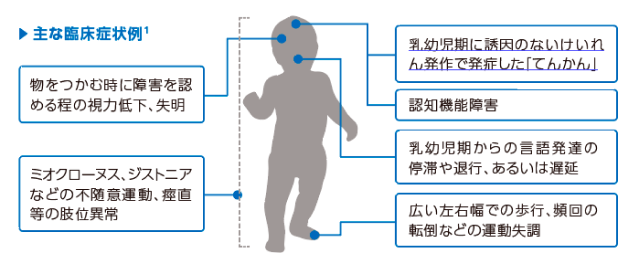 主な臨床症状例